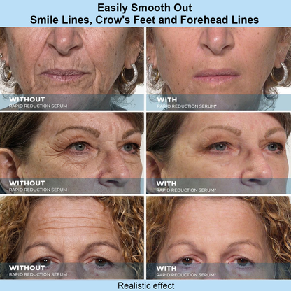 Renuvae™ Instant Face Temporary Tightener – Instant visible results in 60 seconds