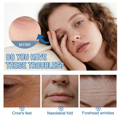 Renuvae™ Instant Face Temporary Tightener – Instant visible results in 60 seconds